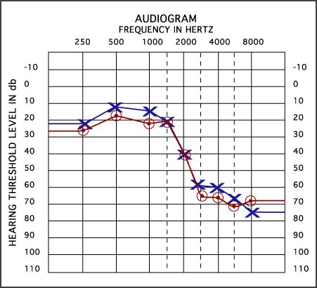 hearingtest online unbiased & free online hearing test