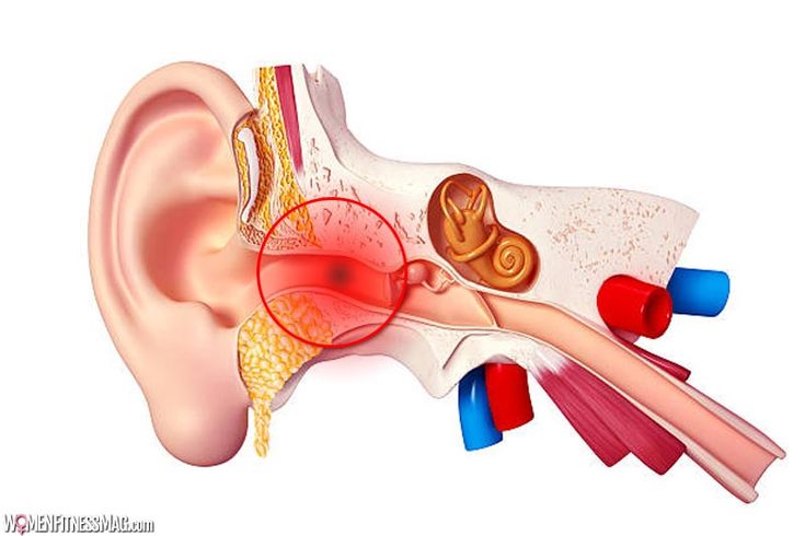 what are middle ear infections (1)